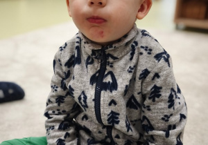 Chłopiec napompował policzki.